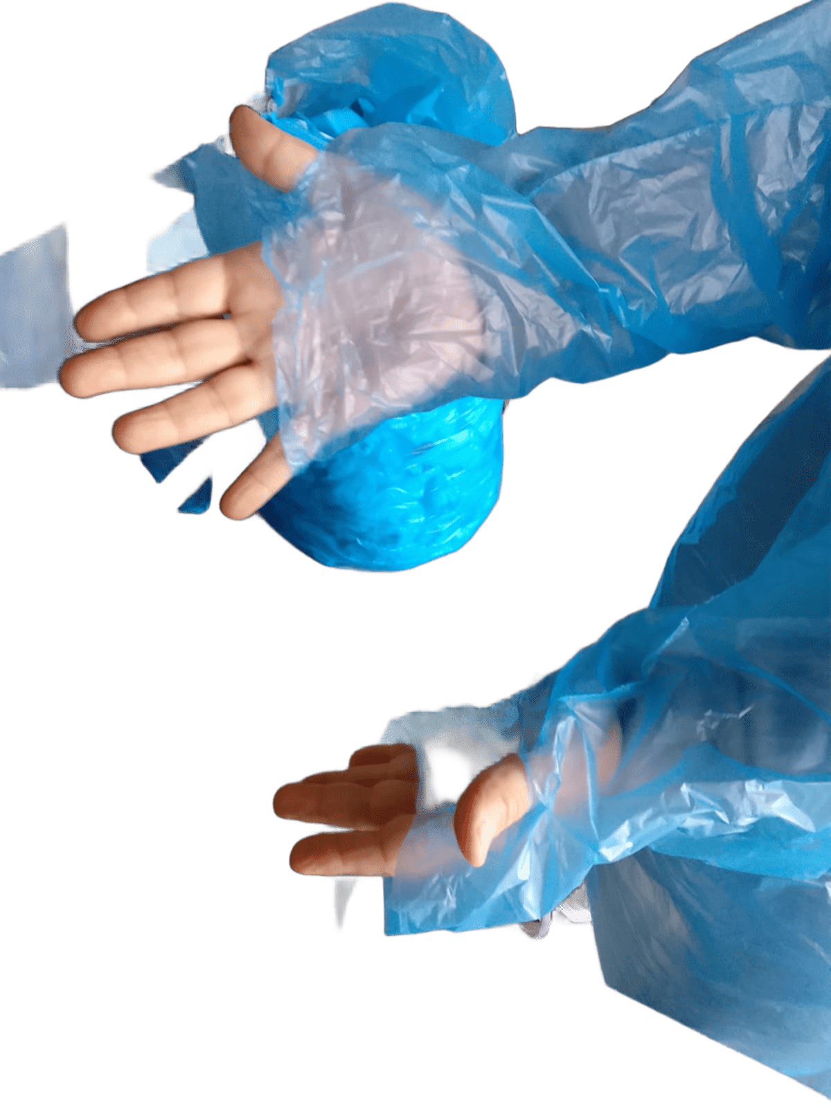 Detalle Técnico Remerón